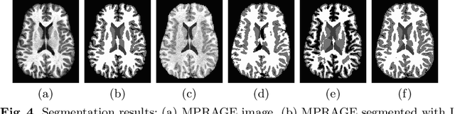 Figure 4 for Contrast Adaptive Tissue Classification by Alternating Segmentation and Synthesis