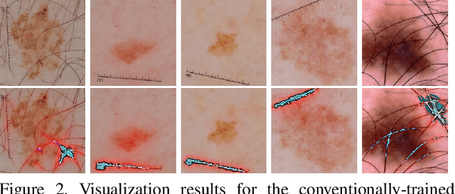 Figure 3 for Skin Lesion Segmentation and Classification with Deep Learning System