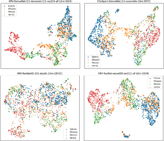 Figure 1 for TorchXRayVision: A library of chest X-ray datasets and models