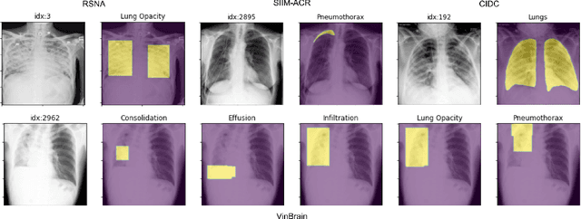 Figure 4 for TorchXRayVision: A library of chest X-ray datasets and models