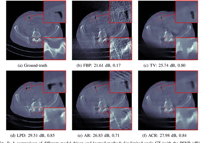 Figure 4 for Learned reconstruction with convergence guarantees