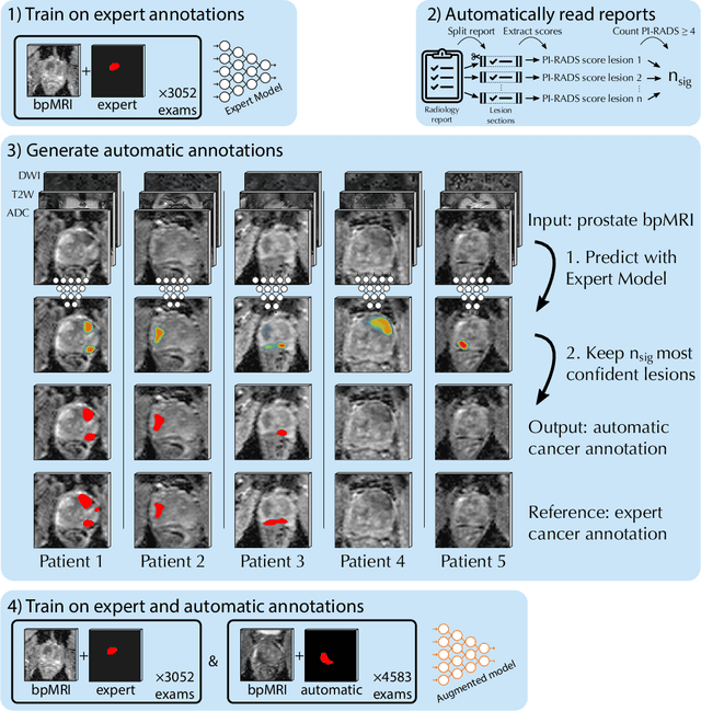 Figure 1 for Report-Guided Automatic Lesion Annotation for Deep Learning-Based Prostate Cancer Detection in bpMRI