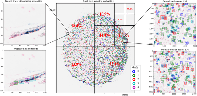 Figure 2 for Deep Learning-Based Quantification of Pulmonary Hemosiderophages in Cytology Slides