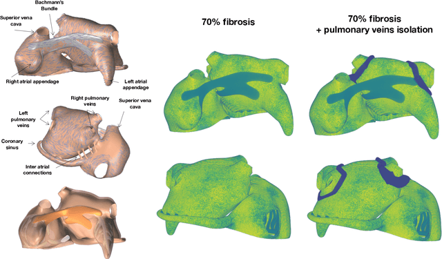 Figure 2 for Fast characterization of inducible regions of atrial fibrillation models with multi-fidelity Gaussian process classification