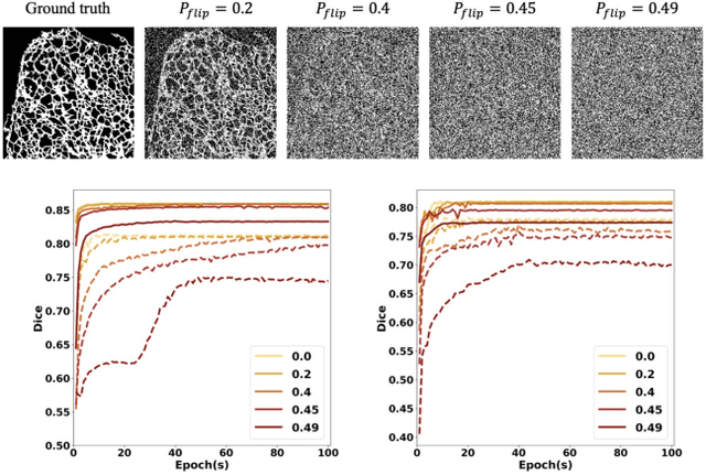 Figure 4 for Deep Neural Networks Learn Meta-Structures to Segment Fluorescence Microscopy Images