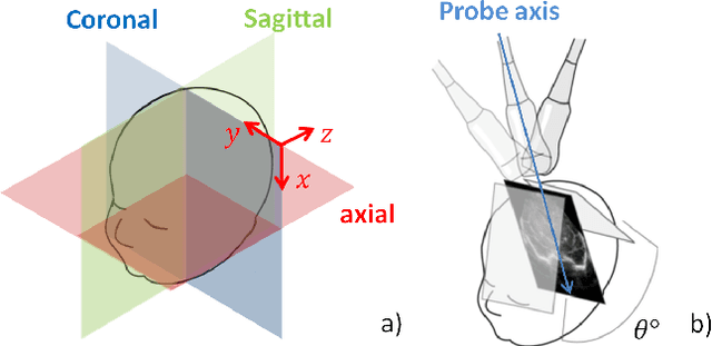 Figure 1 for Automatic Segmentation and Location Learning of Neonatal Cerebral Ventricles in 3D Ultrasound Data Combining CNN and CPPN