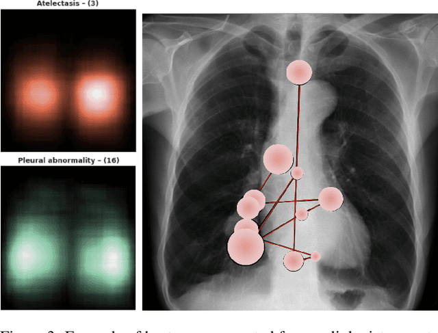 Figure 3 for Improving X-ray Diagnostics through Eye-Tracking and XR
