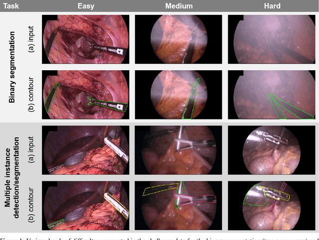 Figure 1 for Robust Medical Instrument Segmentation Challenge 2019