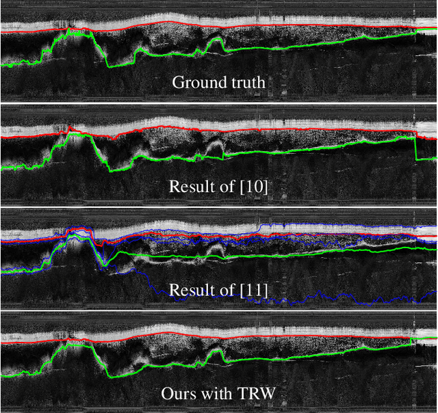 Figure 4 for Automatic Estimation of Ice Bottom Surfaces from Radar Imagery