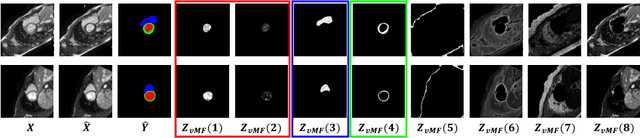 Figure 3 for vMFNet: Compositionality Meets Domain-generalised Segmentation