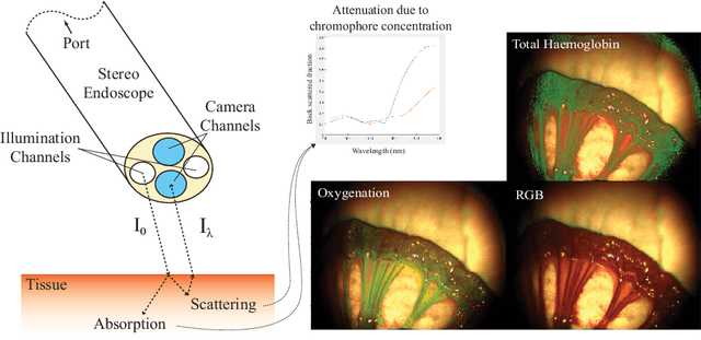 Figure 1 for Inference of Haemoglobin Concentration From Stereo RGB