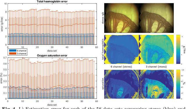 Figure 4 for Inference of Haemoglobin Concentration From Stereo RGB