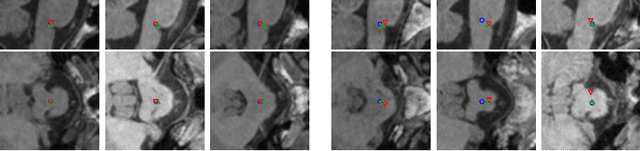 Figure 4 for Multi-dimensional Gated Recurrent Units for Automated Anatomical Landmark Localization