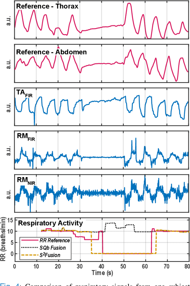 Figure 4 for Multispectral Video Fusion for Non-contact Monitoring of Respiratory Rate and Apnea
