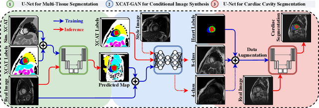 Figure 1 for XCAT-GAN for Synthesizing 3D Consistent Labeled Cardiac MR Images on Anatomically Variable XCAT Phantoms