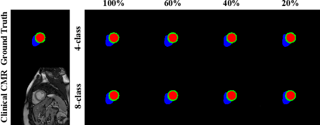 Figure 4 for XCAT-GAN for Synthesizing 3D Consistent Labeled Cardiac MR Images on Anatomically Variable XCAT Phantoms