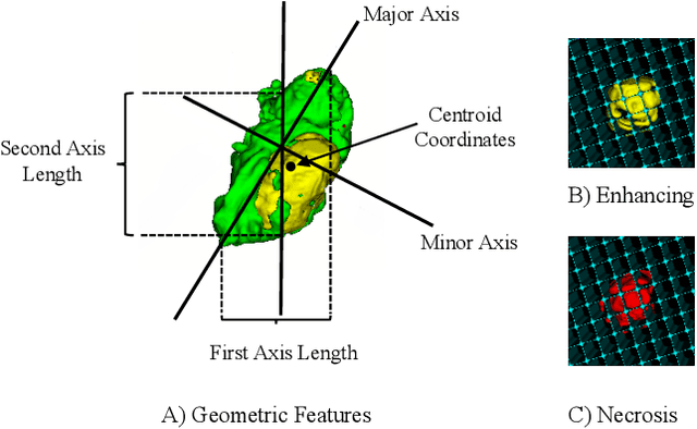 Figure 2 for Glioblastoma Multiforme Prognosis: MRI Missing Modality Generation, Segmentation and Radiogenomic Survival Prediction
