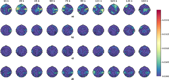 Figure 1 for Temporal EigenPAC for dyslexia diagnosis