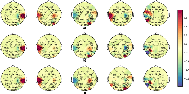 Figure 3 for Temporal EigenPAC for dyslexia diagnosis