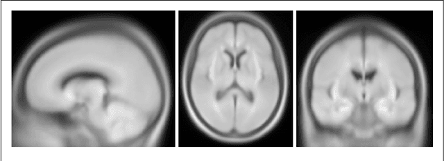Figure 3 for Latent Space Analysis of VAE and Intro-VAE applied to 3-dimensional MR Brain Volumes of Multiple Sclerosis, Leukoencephalopathy, and Healthy Patients