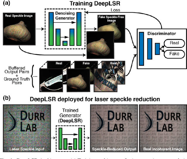 Figure 1 for DeepLSR: Deep learning approach for laser speckle reduction