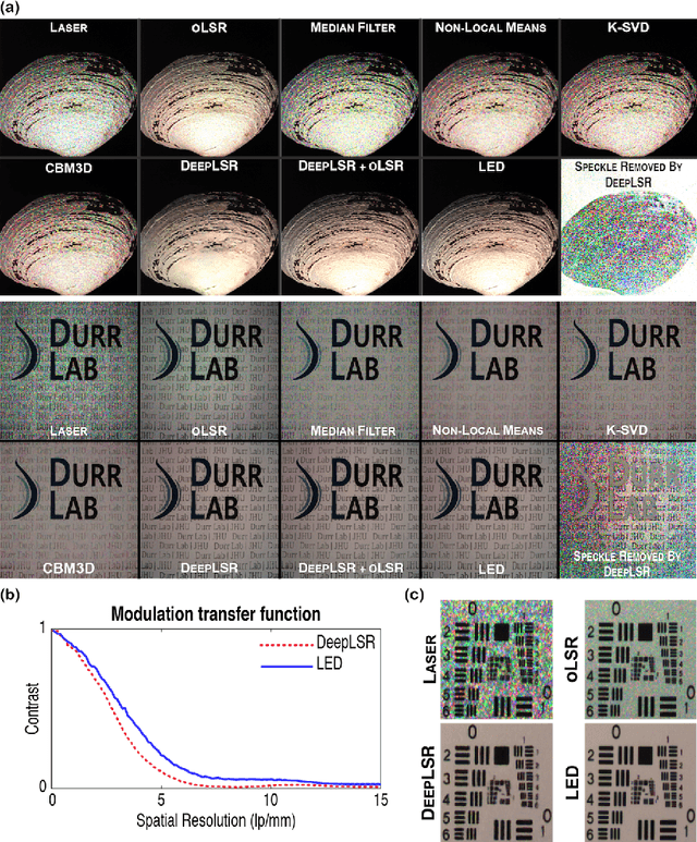 Figure 4 for DeepLSR: Deep learning approach for laser speckle reduction
