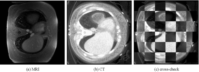 Figure 1 for Structure Unbiased Adversarial Model for Medical Image Segmentation