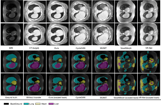 Figure 2 for Structure Unbiased Adversarial Model for Medical Image Segmentation