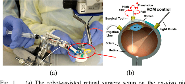 Figure 1 for Spotlight-based 3D Instrument Guidance for Retinal Surgery