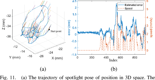 Figure 2 for Spotlight-based 3D Instrument Guidance for Retinal Surgery