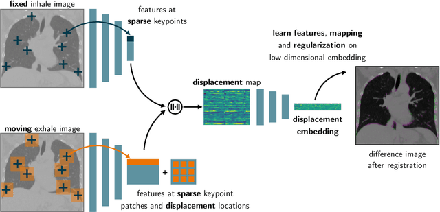 Figure 1 for Tackling the Problem of Large Deformations in Deep Learning Based Medical Image Registration Using Displacement Embeddings