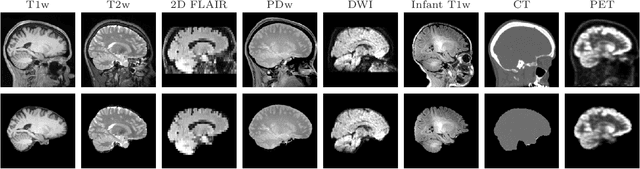 Figure 1 for SynthStrip: Skull-Stripping for Any Brain Image