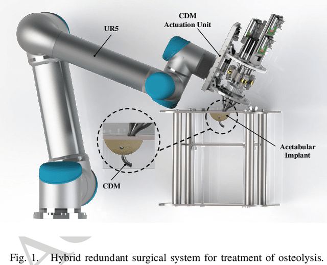 Figure 1 for A Convex Optimization Framework for Constrained Concurrent Motion Control of a Hybrid Redundant Surgical System