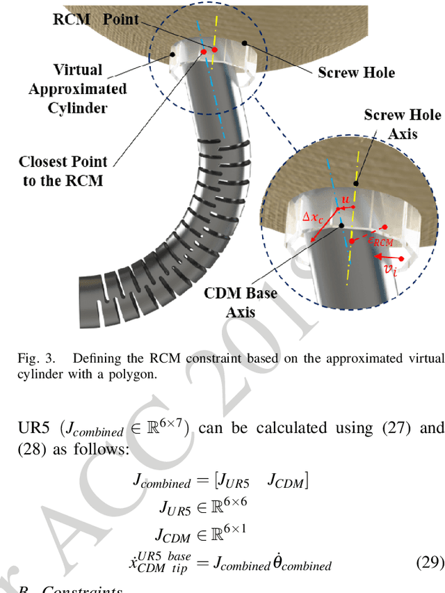 Figure 3 for A Convex Optimization Framework for Constrained Concurrent Motion Control of a Hybrid Redundant Surgical System
