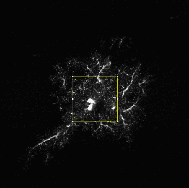 Figure 3 for Estimation of Optical Aberrations in 3D Microscopic Bioimages