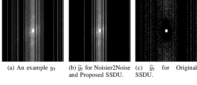 Figure 1 for Self-supervised deep learning MRI reconstruction with Noisier2Noise