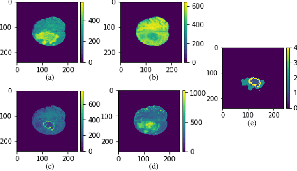 Figure 3 for A Computation-Efficient CNN System for High-Quality Brain Tumor Segmentation