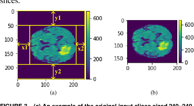 Figure 4 for A Computation-Efficient CNN System for High-Quality Brain Tumor Segmentation