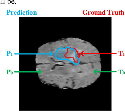 Figure 2 for A Computation-Efficient CNN System for High-Quality Brain Tumor Segmentation