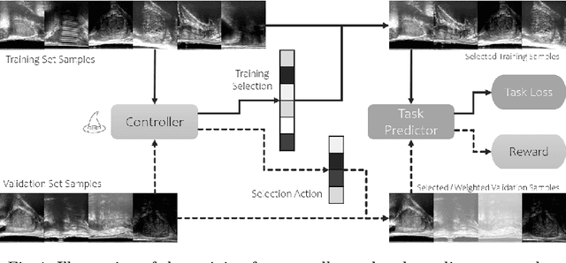 Figure 1 for Learning image quality assessment by reinforcing task amenable data selection