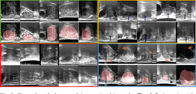 Figure 3 for Learning image quality assessment by reinforcing task amenable data selection