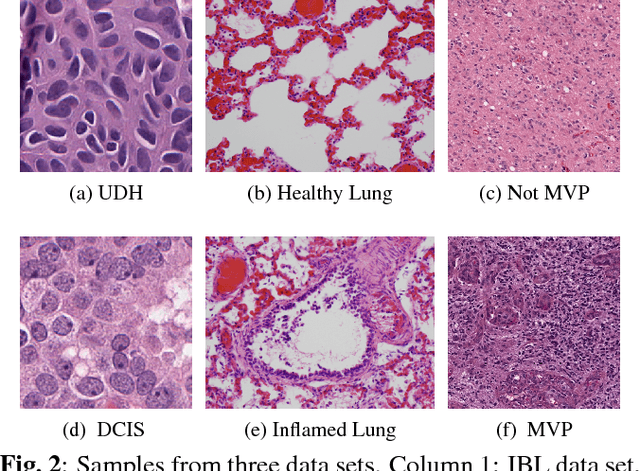 Figure 3 for DFDL: Discriminative Feature-oriented Dictionary Learning for Histopathological Image Classification