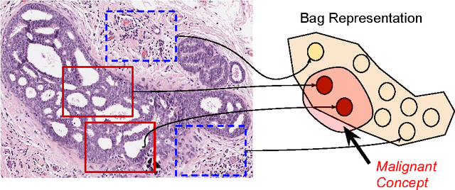 Figure 1 for Learning Robust Hash Codes for Multiple Instance Image Retrieval
