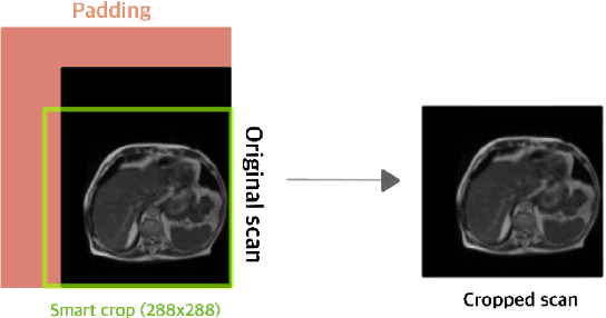 Figure 3 for Automated GI tract segmentation using deep learning