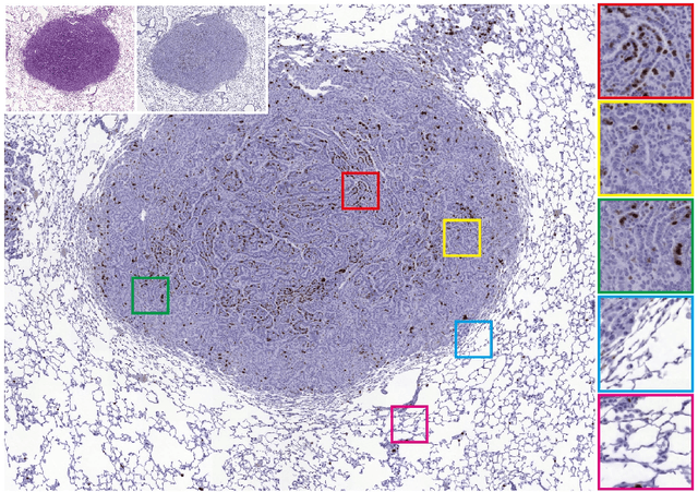 Figure 1 for Ultra-high-resolution unpaired stain transformation via Kernelized Instance Normalization