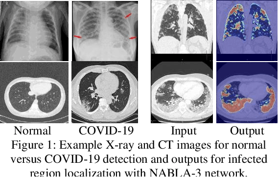 Figure 1 for COVID_MTNet: COVID-19 Detection with Multi-Task Deep Learning Approaches