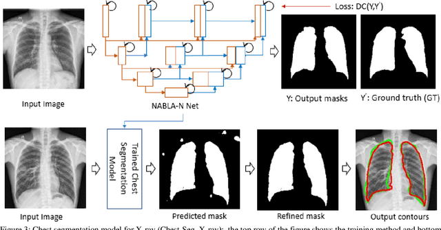 Figure 3 for COVID_MTNet: COVID-19 Detection with Multi-Task Deep Learning Approaches