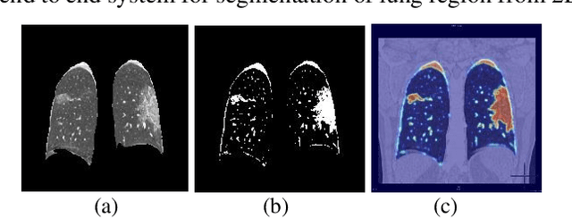 Figure 4 for COVID_MTNet: COVID-19 Detection with Multi-Task Deep Learning Approaches