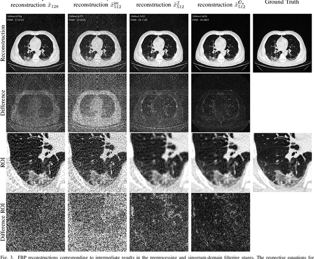 Figure 3 for WNet: A data-driven dual-domain denoising model for sparse-view computed tomography with a trainable reconstruction layer
