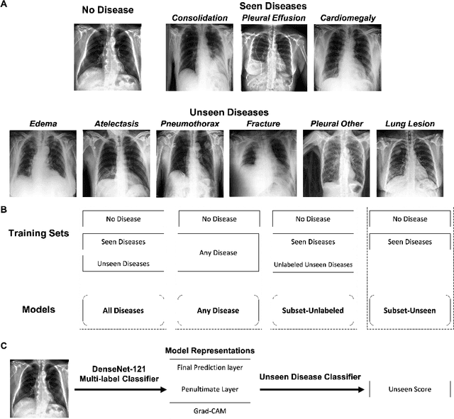 Figure 1 for CheXseen: Unseen Disease Detection for Deep Learning Interpretation of Chest X-rays